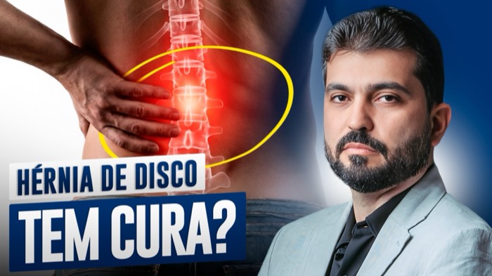 Thumbnail produzida pela V2